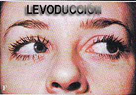 deformadas_13.gif
