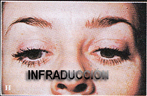 deformadas_47.gif